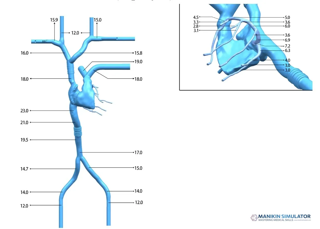 Drawing of Cardiac Veins Simulation Model (Pacemaker Electrode Implantation)