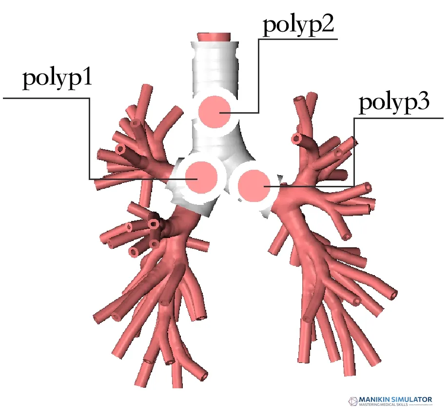 Drawing of Endobronchial Therapy Training Model Drawing of Endobronchial Therapy Training Model