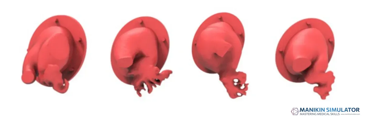 Drawing of Left atrial appendage training model Drawing of Left atrial appendage training model