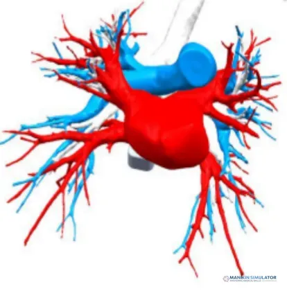 Drawing of Lung Nodule Puncture Model Drawing of Lung Nodule Puncture Model