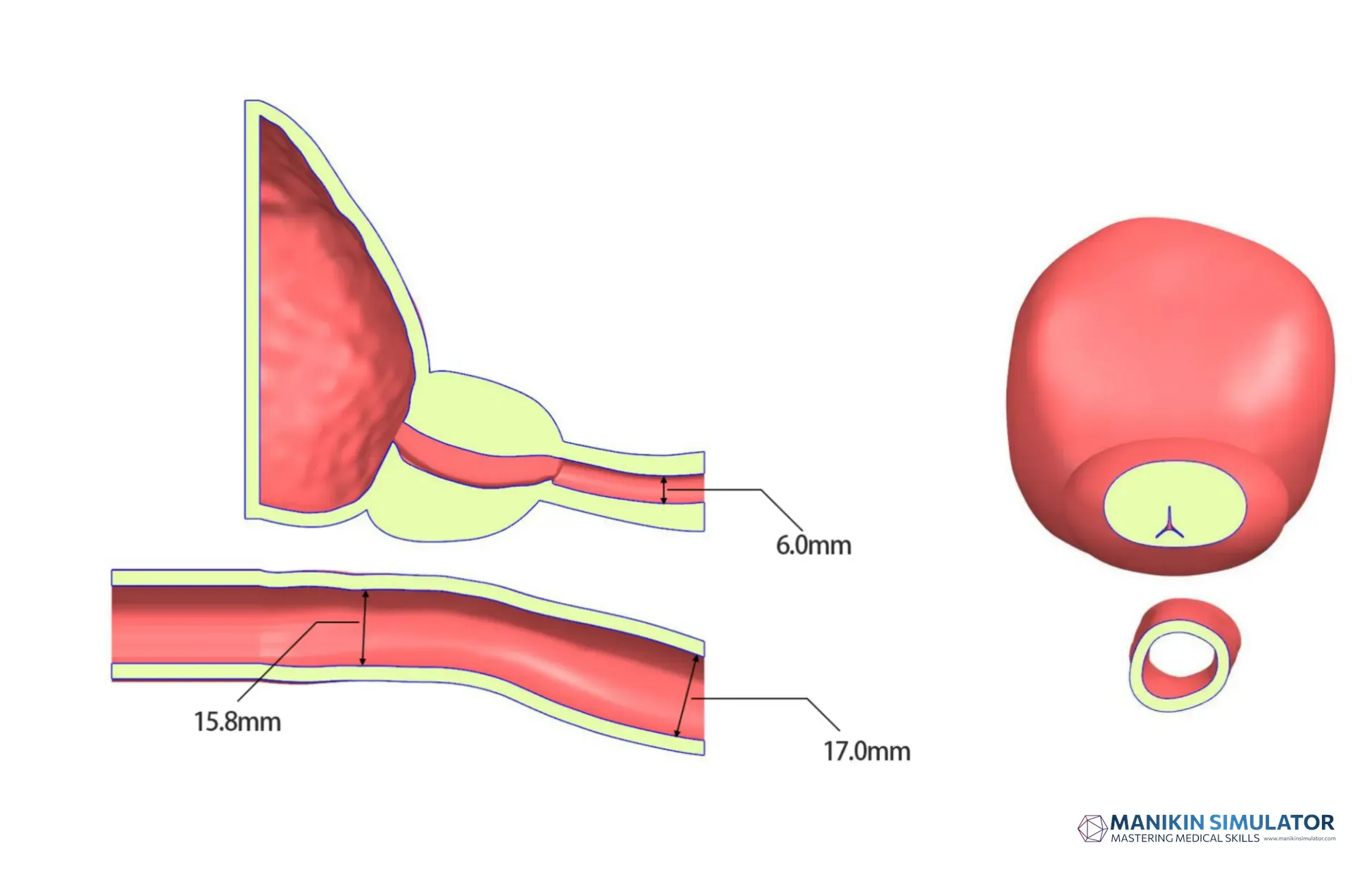 Drawing of Prostate ultrasound training model type A