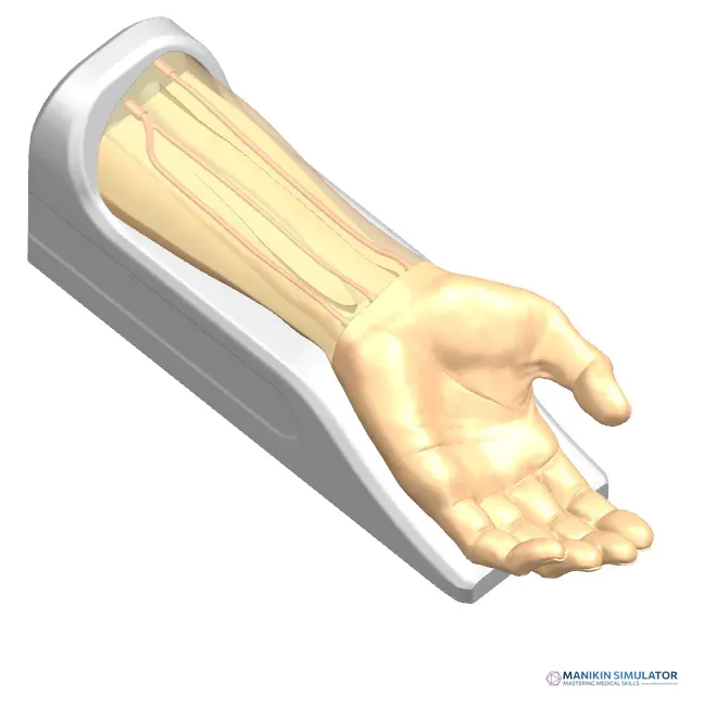 Drawing of Radial Artery Puncture Operation Model (Ultrasound-Guided)