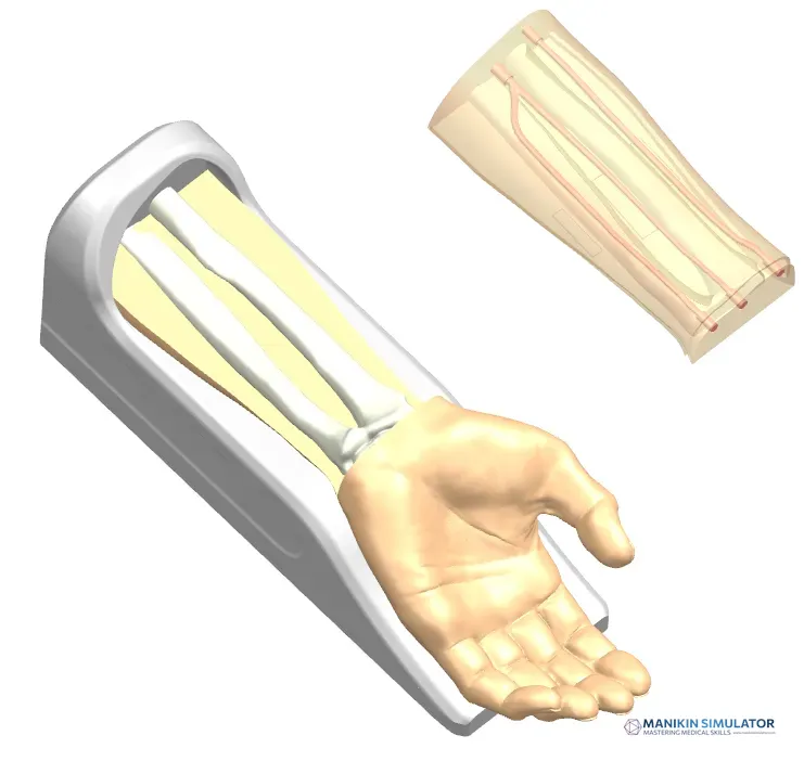 Drawing of Radial Artery Puncture Operation Model (Ultrasound-Guided)