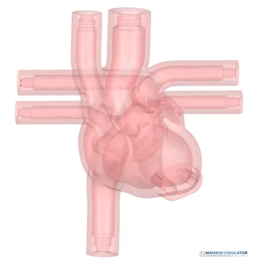 Drawing of Ultrasound Cardiac Training Model Drawing of Ultrasound Cardiac Training Model