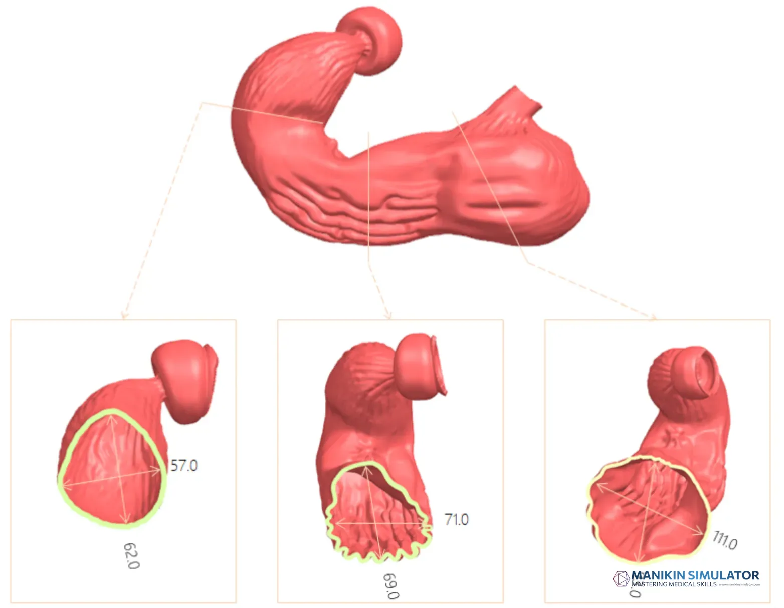 Drawing of Upper Gastrointestinal training model
